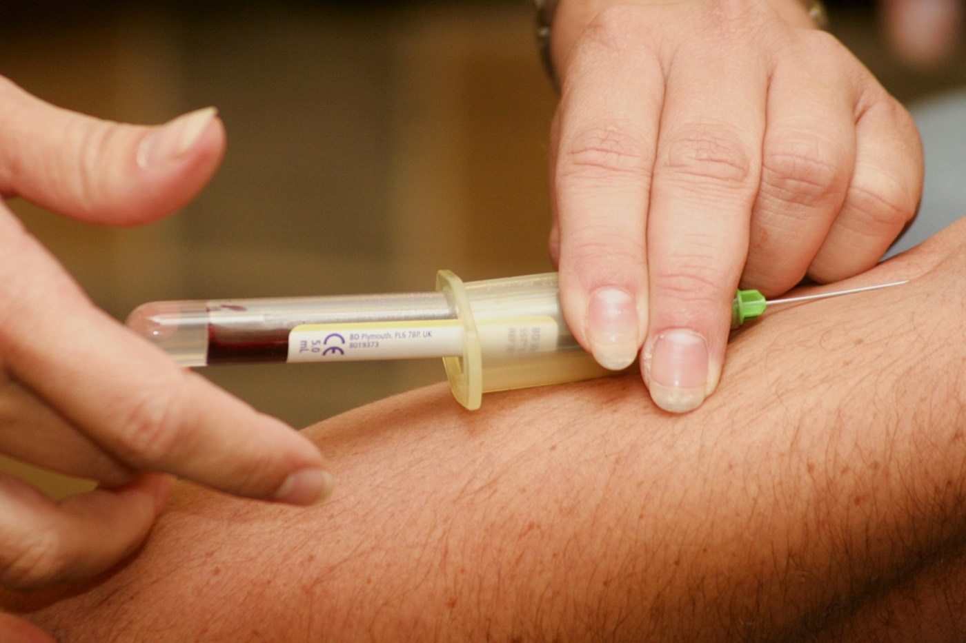 A gloved hand drawing a blood sample from a patient's arm